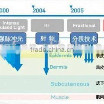 Painless HIFU-C High Intensity Wrinkle Removal Face Lift Machine High Focused Ultrasonic photo-2