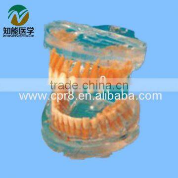 Transparent adult tooth model BIX - L1007