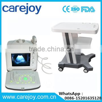 OEM service High sensitivity probe Digital Portable Ultrasound Scanner with Trolley