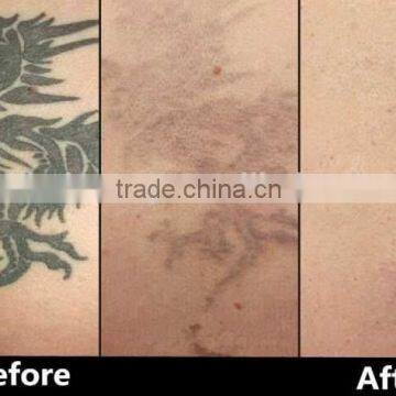 1 HZ Q-switched Nd The Vertical ND Yag Laser For Tattoo Removal 532nm Machine / Medical Use Tattoo Remover Nd Yag Laser Machine