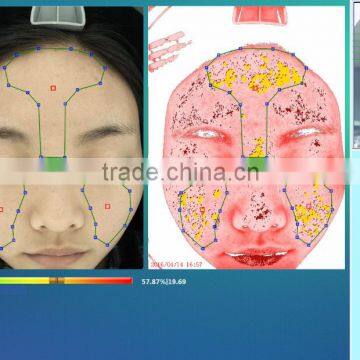 Newest!!! CE Approval Esthetic Equipment Skin Analysis/skin Analyzer photo-6