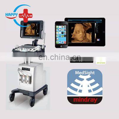 Mindray DC-30 Ultrasound Equipment/Mindray Color Doppler Ultrasound photo-3