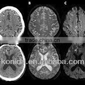 imaging xray film,industrial x-ray film digitizer,industry digitizer