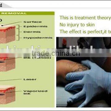 Painless Stationary Beauty Equipment Salon And Home Use 8 White In 1 With Multi Function Acne Removal Swing Arm photo-3