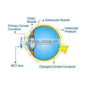 MCT Technology for daily eyes contact lenses