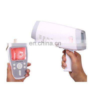 MY-F005 medical instrument portable handheld electronic video colposcope for gynecology