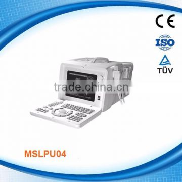 CMEF hot sale! MSLPU04 China portable ultrasound machine price