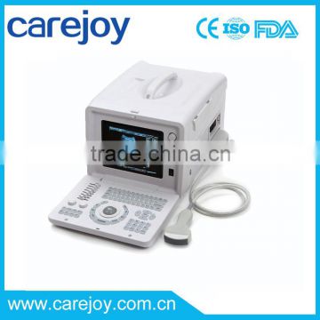 Promotion!!CE approved Laptop/Portable Ultrasound Scanner with 3.5Mhz multi-frequency convex probe RUS-6000D