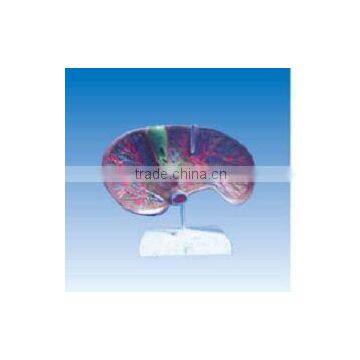 Liver and Biliary anatomy, hepatic blood vessels ,bile ducts distribution in the liver model