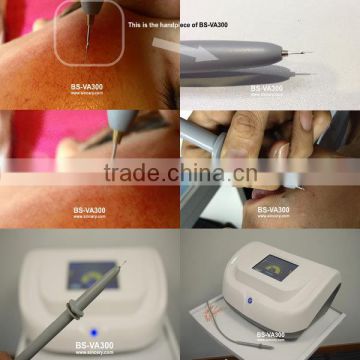 flagship product Vascular vain removal machine