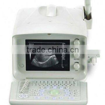 portable b ultrasound machine for checking body