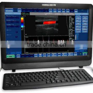 Full Digital Color Doppler Ultrasound