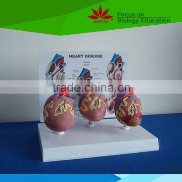 Direct factory supplied human heart disease model