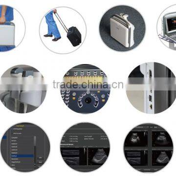 Medical Veterinary Equipment Trolley Color Doppler Ultrasound Machine System photo-2