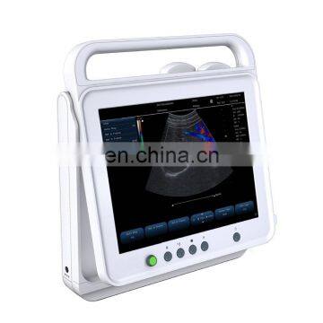 MY-A023G medical products imaging ultrasound system color doppler portable ultrasound scan machine