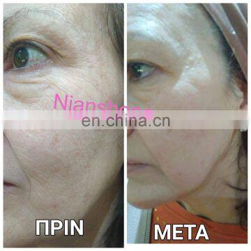 Double Screen 3 In1 Multi-function OPT IPL Laser Hair Removal Tattoo Removal Equipment Laser Hair Removal for Salon photo-7