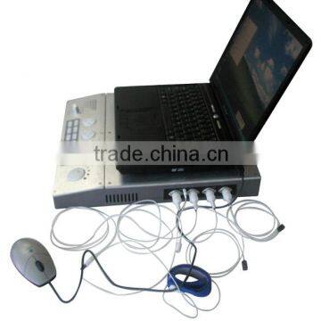 2015 CE&ISO Approved EMG EP Systems Electromyography Myoelectricity Measuring System for Neurology photo-2