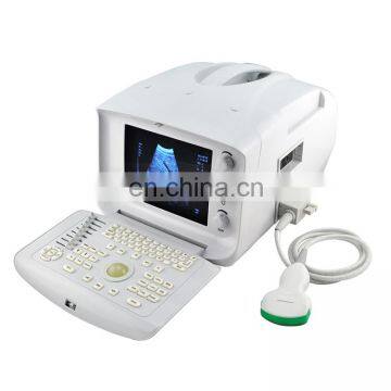 MY-A001-N digital portable ultrasound / Portable Ultrasound Diagnostic Scanner