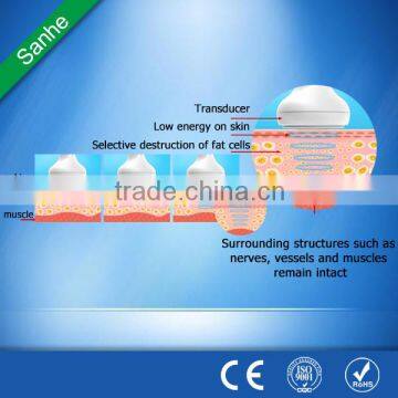Distributor Wanted!!Sanhe New Products Hifu Machine 33mm-63mm Fat Reduce Hifushape Hifu Slimming Fat Reduce Machine