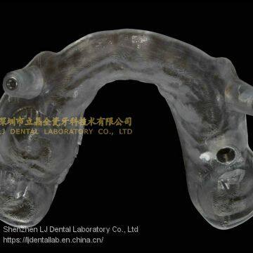 Implant surgical guide stent, implant radiographic templates, implant guide splints, laboratoire dentaire, Dentallabor, laboratorio dental, dental laboratory, Shenzhen LJ dental lab China