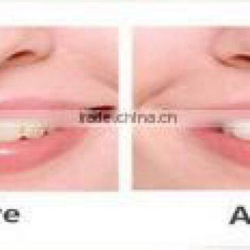 Innovation 10ml Gel, Mint Flavor Teeth Whitening Gel