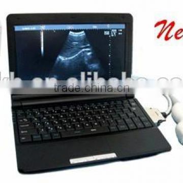 2016 Promotion Medical Portable Laptop Clinic Hospital Ultrasound Scanner Machine with 3.5Mhz Convex Probes--RUS-9000F-Shelly