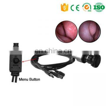 Mini portable android/iphone/smartphone ent endoscope camera video endoscope price