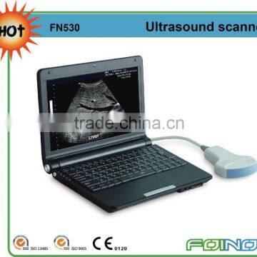 FN530 HOT selling full digital laptop ultrasound equipment