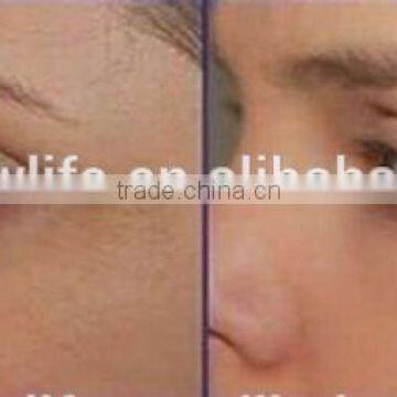 NL-HS202 2016 HOT SALE!!! Diamond Dermabrasion Facial Machine/beauty Salon Equipment/promote Circulation photo-6