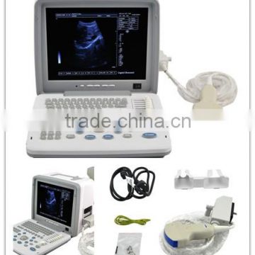 Promotion multi-frequency Portable Ultrasound Scanner with Convex Linear micro-convex probe optional