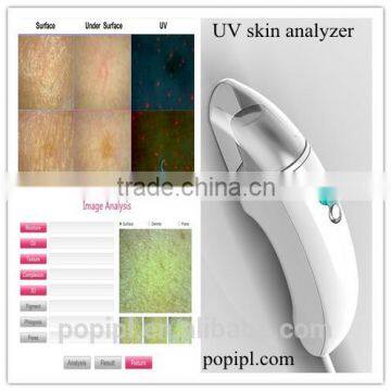 skin analyzer machine 10.4 inch touch screen UV skin analyzer machine with Andorid operating win10 ce skin scope analyzer