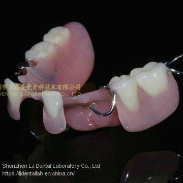 Dental Partial Acrylic Denture, Complete Denture, Full Dental Dentures, Laboratoire Dentaire, Dentallabor, Laboratorio Dental, Dental Laboratory, Shenzhen LJ Dental Lab China photo-3