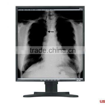 medical display