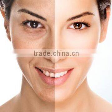 IPL Beauty Machine to Get Face Rejuvenation With Hair Removal Function photo-3