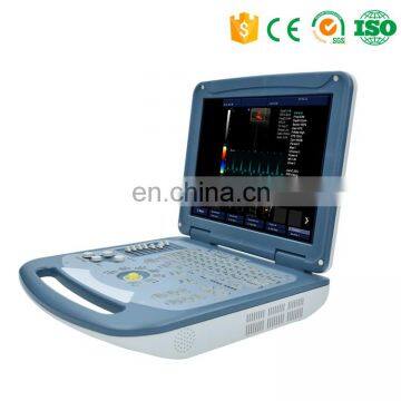 Direct Sale Medical Ecograph Laptop notebook Portable Color Doppler Ultrasound Scanner