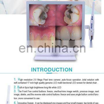 MY-M067-1 Intra Oral Camera Medical Dental Equipment Wifi Wireless Intraoral Camera Dental photo-3