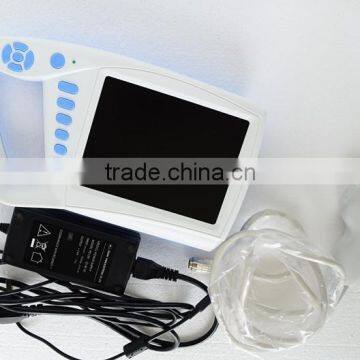 FM-9004 2015 New Palm Veterinary Ultrasound Scanner CE approved