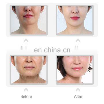 Facial Chin V Shaped Lifting Firming Therapy Beauty Device for Personal Care photo-4