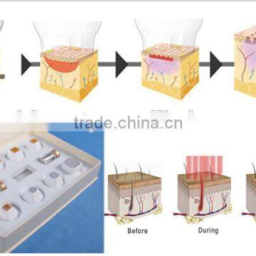 Hot Sale Portable Home-use RF 9D Thermacool Skin Resurfacing and RF Thermacool Effectively Machine photo-4