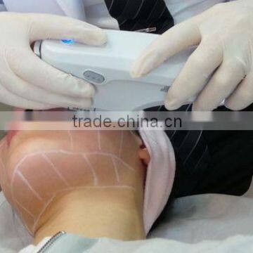 Newest Hifu/high Intensity Focused Ultrasound photo-5