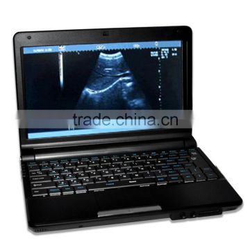 Low factory price!CE approved Laptop Ultrasound Scanner /Ultrasound MachineRUS-9000F with 7.5Mhz linear probe