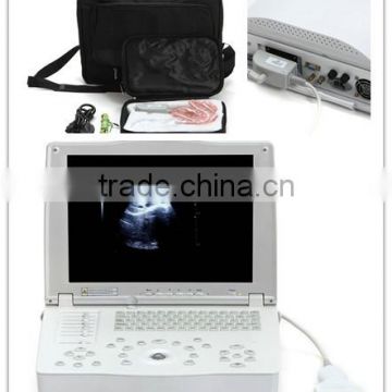 Cheap price Laptop Ultrasound Scanner with convex probe micro convex linear transvaginal rectal probe