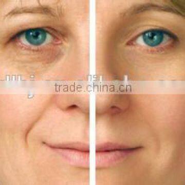 The Most Impressive Safe Beauty Therapy Radio Frequency For Home Use Portable Machine photo-4