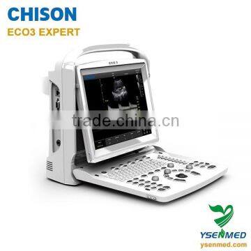 medical User-friendly b/w 2d portable ultrasound CHISON ECO3 EXPERT