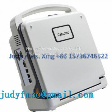Portable Color Doppler Ultrasound Scanner System photo-4