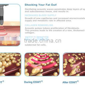 Portable Beauty System Acoustic Shockwave for Cellulite Removal Device - ESWT SD photo-6