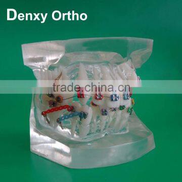 transparent FDA dental orthodontic acrylic teeth models