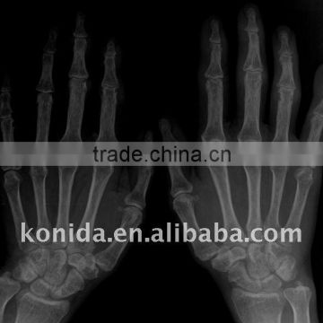 x-ray machine accessories,dry image films,medical x-ray film