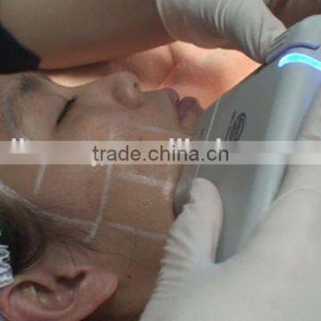 Anti Age Hifu/hifu Face Lift Ultrasound System/hifu Face Lift Ultrasound System photo-5