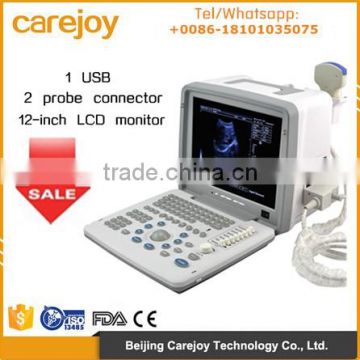 Good price Diagnostic Ultrasonic system 12 inch Ultrasound machine with 3.5Mhz convex probe RUS-9000B with CE ISO mark